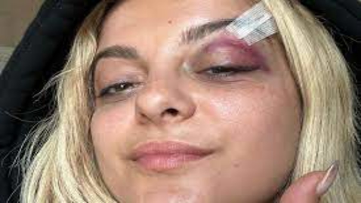 "Shocking Incident: Bebe Rexha Hit by Cellphone During Concert in Manhattan!"