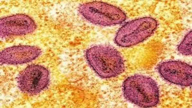 "First UK Case of Mpox Variant Clade Ib Confirmed in London—Health Officials Issue Low-Risk Alert!"