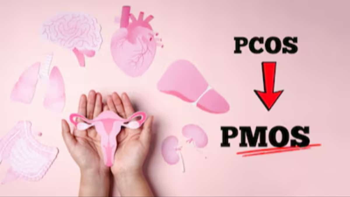PCOS Renamed PMOS: What the Historic Name Change Means for Women’s Health Worldwide